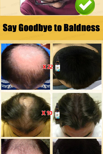 The latest hair serum for 2025. Quickly repair hair follicles and say goodbye to hair loss.