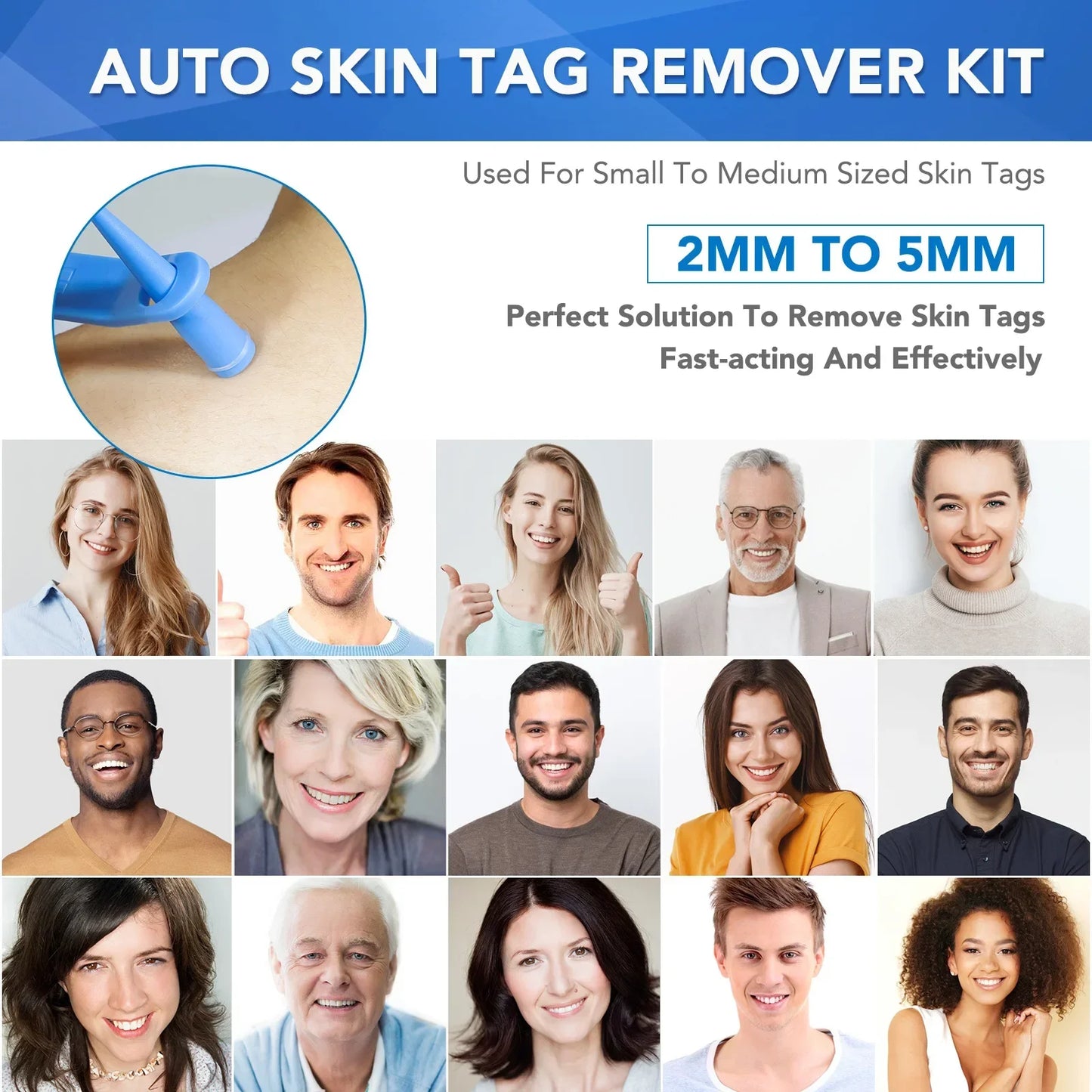 Simple Wart Removal Tool Set Skin Tag Removeal Tool Easy To Clean Skin Care Tool Skin Tag Removal Care Products