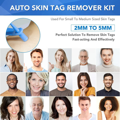 Simple Wart Removal Tool Set Skin Tag Removeal Tool Easy To Clean Skin Care Tool Skin Tag Removal Care Products