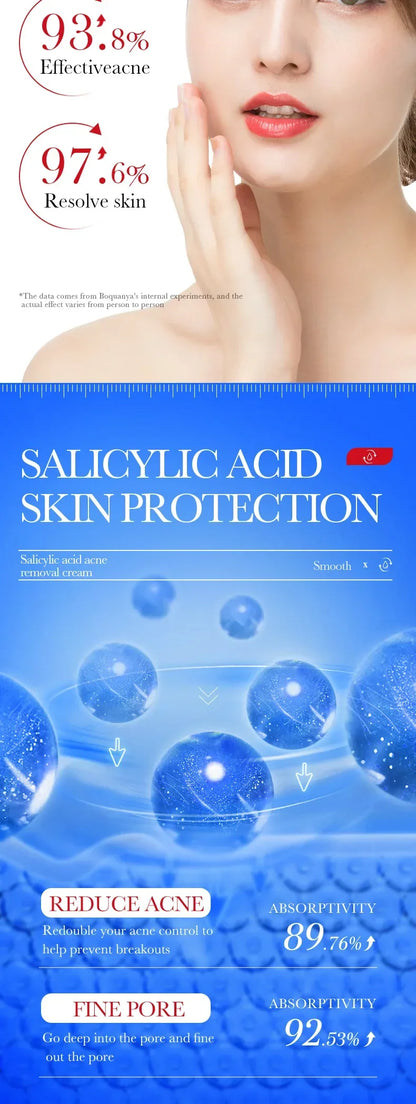 Salicylic Acid Face Cream Acne Creams Mark Repair Firming Moisturizing Blackhead Remover skincare Facial Cream