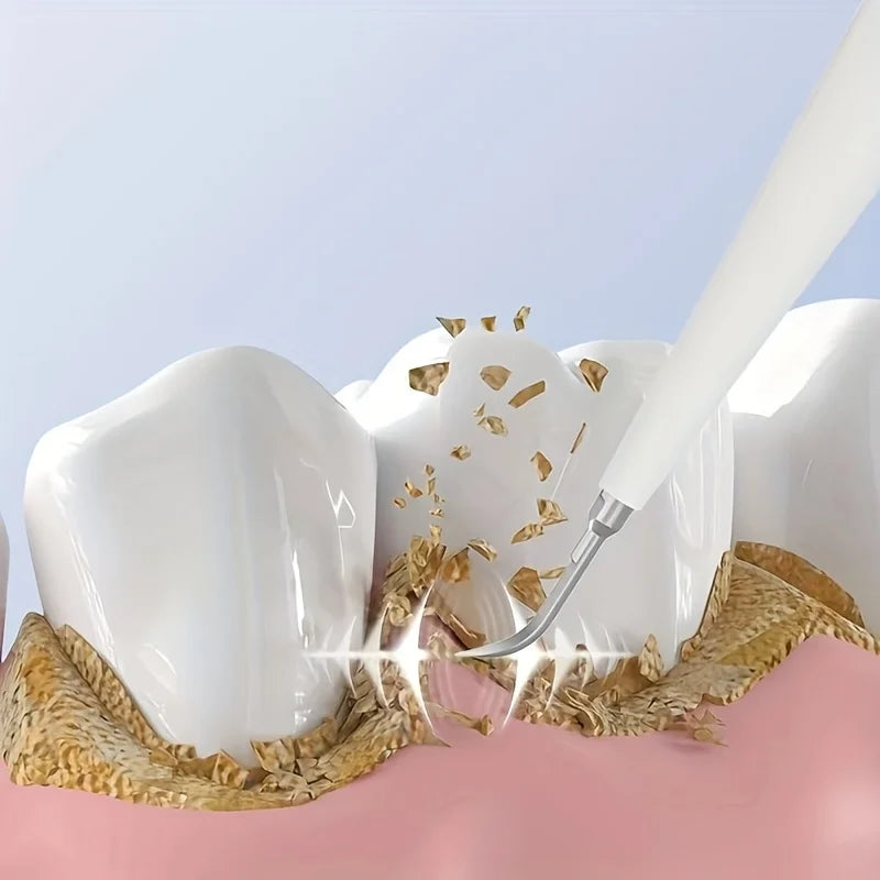 Electric Teeth Whitening Dental Calculus Scaler Plaque Coffee Stain Tartar Removal High Frequency Sonic Toothbrush Teeth Cleaner