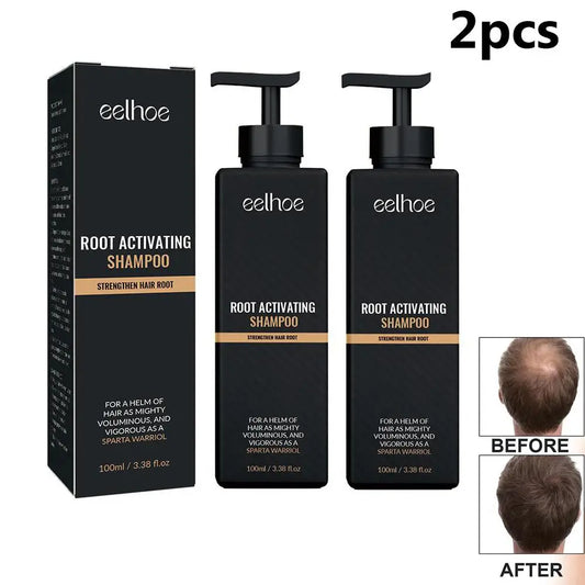 Anti Baldness Shampoo Thickening Shampoo Root Activator Shampoo Nourish Hair Regrowth Shampoo For Thinning Hair & Hair Loss