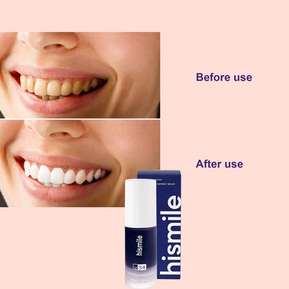 30ml Purple Teeth Whitening Purple Toothpaste White Teeth Toothpaste For Pain Sensitive Teeth Teeth Whitening Toothpaste