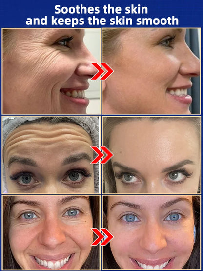 Make you look younger and young