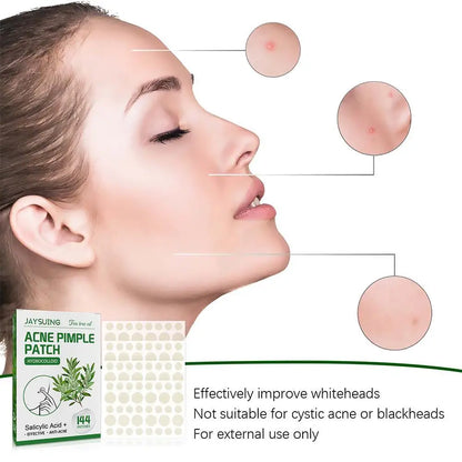 144pcs Acne Pimple Patches Translucent Matte Hydrocolloid Salicylic Acid Tea Tree Oil For Inflamed Acne Improve Whiteheads