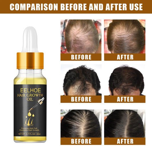 Fast Hair Growth Hair Care Essential Oil Essence Original Authentic Anti-loss Liquid Health Care Beauty Dense Hair Growth Serum