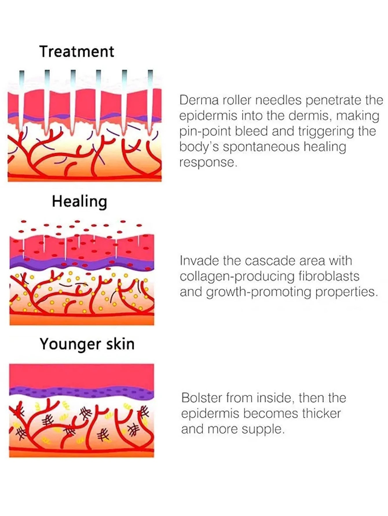 1 Pcs 540 Microneedle Rollers Dermatological Derma Micro Needles Titanium Help Hair Softens Acne Scars Skin Face Care Tool