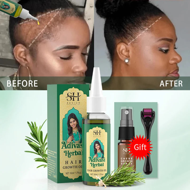 Ayurvedic Hair Growth Oil India Adivasi herbal Hair Growth Oils Anti Hair Loss Fast Regrowth Thicken Serum Hair Growth Products