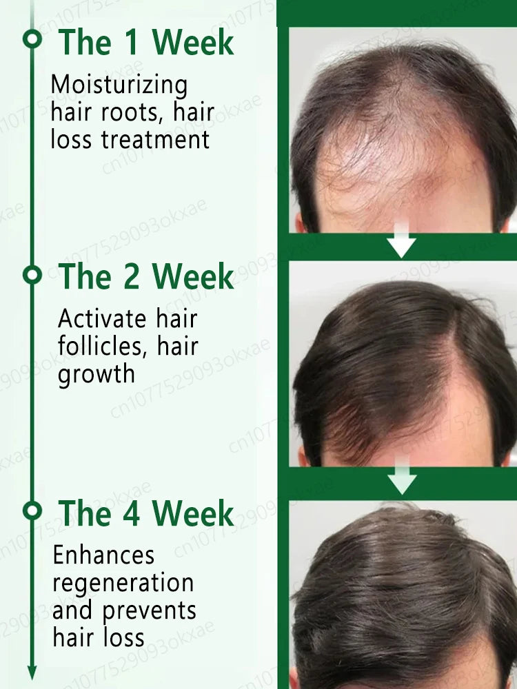 2025 Hair growth oil, repair baldness, hairline, rapid hair growth hair growth oil for men