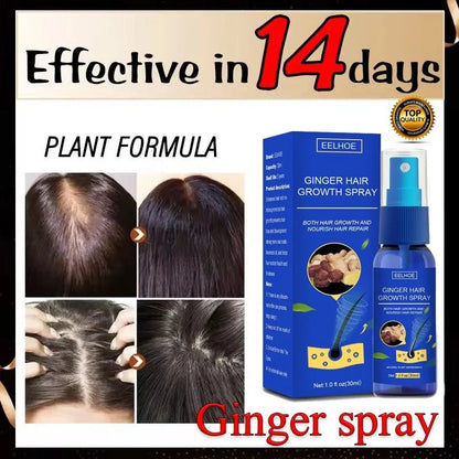 Ginger Hair Growth spray Anti Hair Fall Hair Loss Treatment Hair Growth Essence Oil for Men Women hair treatment