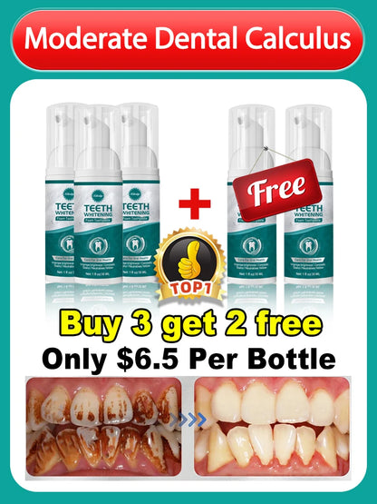 Solve all dental problem tooth decay repair tooth repair fast teeth whitening clean teeth teeth repair cavities