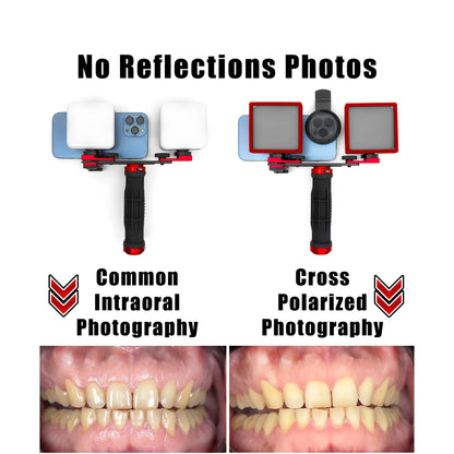 Dental Photo LED Light. Dental Photography Light. Macro, Polarizer, Intraoral, Denture Photo With Phone Lamp For Dentistry