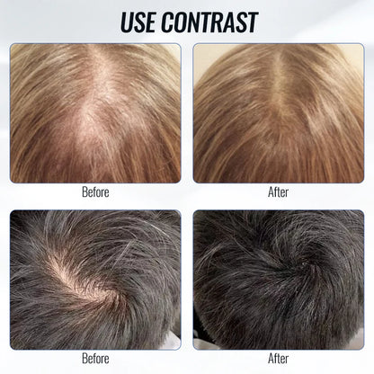 Scalp Applicator Liquid Comb For Hair Scalp Treatment Essential Oil Guiding Massager Brush Hair Growth Serum Oil Apply Device