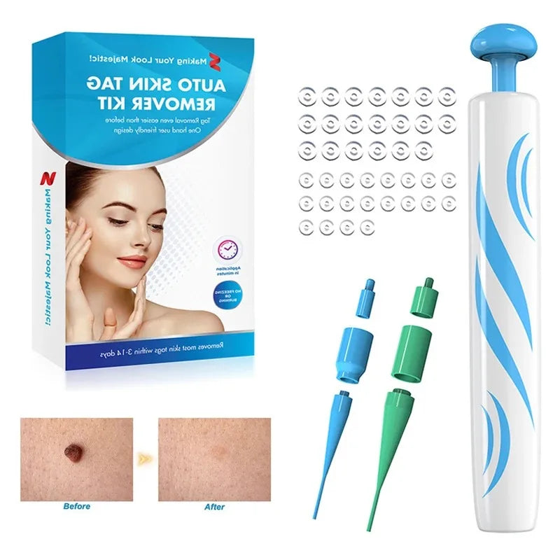 2-IN-1 Auto Skin Tag Removal Tool Kit Painless Skin Label Mole Acne Wart Removal Pen with Cleansing Swabs Facial Skin Care Tool
