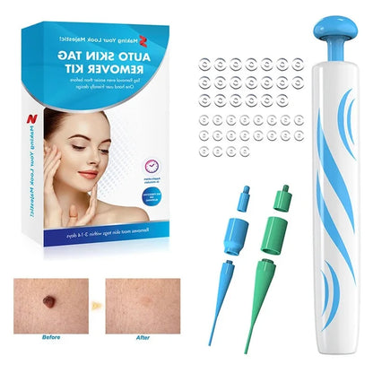 2-IN-1 Auto Skin Tag Removal Tool Kit Painless Skin Label Mole Acne Wart Removal Pen with Cleansing Swabs Facial Skin Care Tool