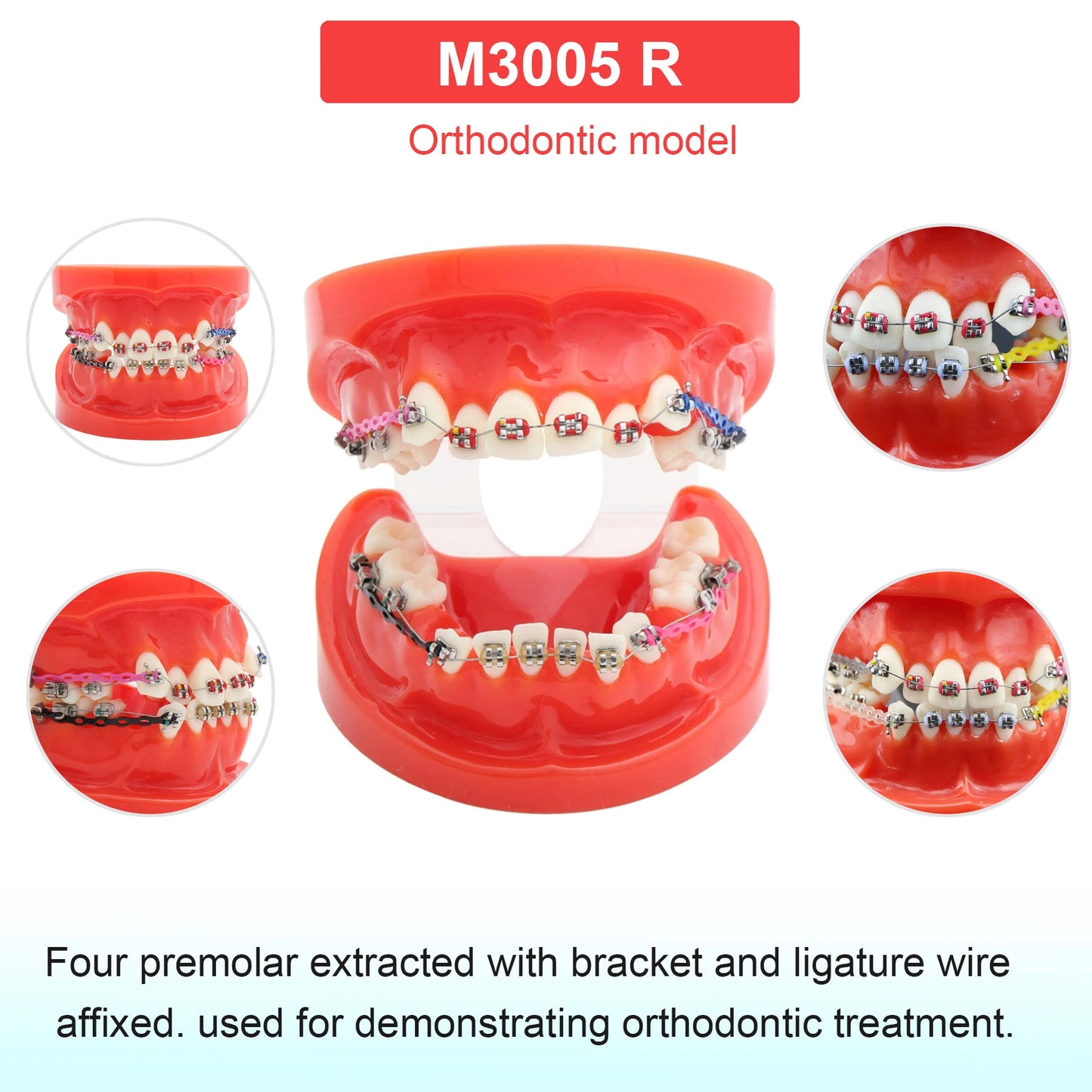Dental Teeth Model Dental Teaching Models Implant Model Removable Dentistry Model Teeth For Training Studying Patient Education