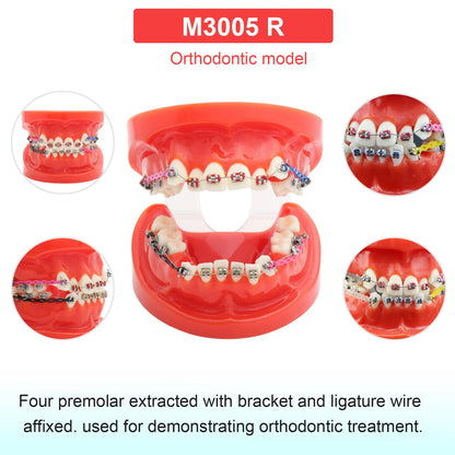 Dental Teeth Model Dental Teaching Models Implant Model Removable Dentistry Model Teeth For Training Studying Patient Education