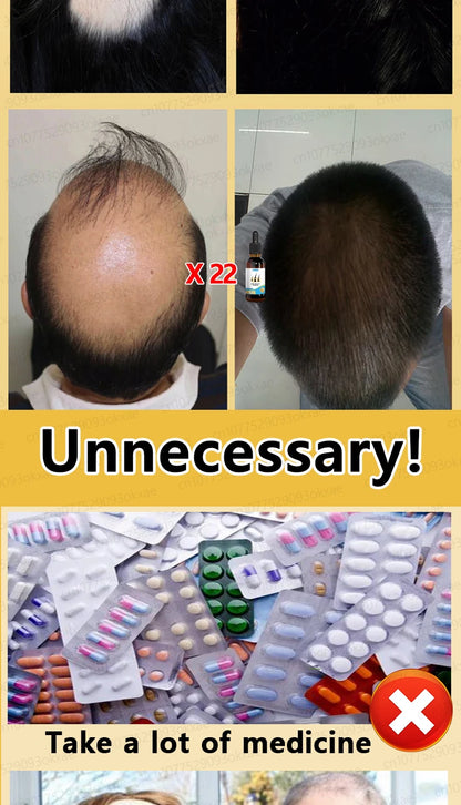 The latest hair serum for 2025. Quickly repair hair follicles and say goodbye to hair loss.