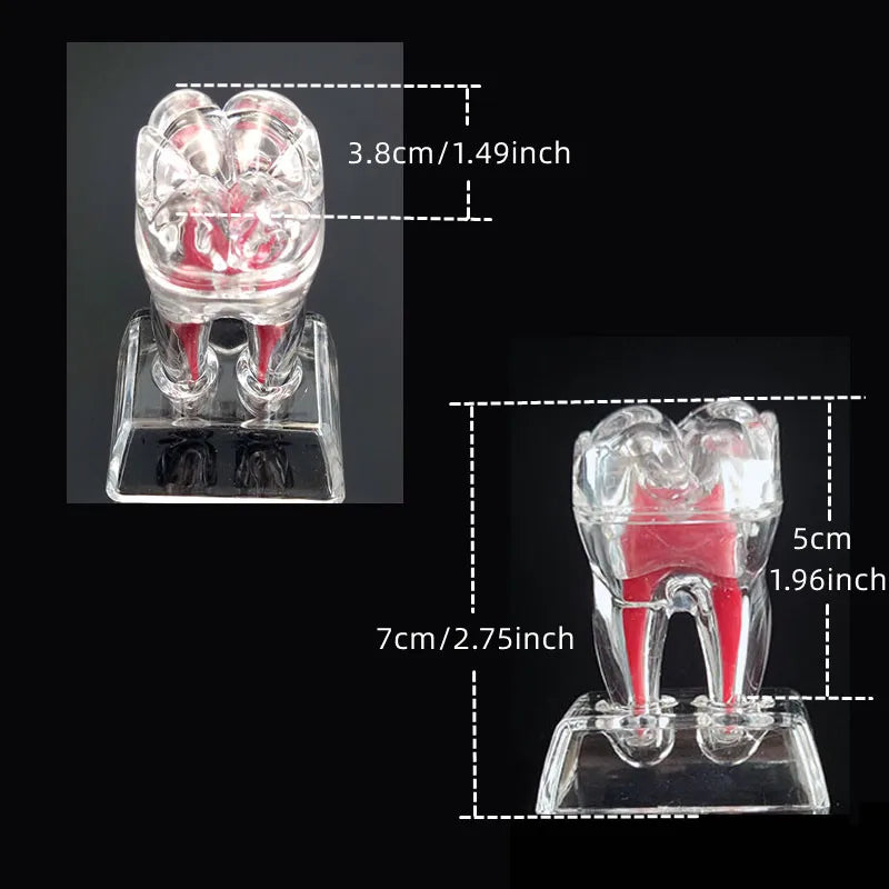 Dental Anatomical Model Transparent Luminous Detachable Single Tooth Decomposition Dentistry Clinic Ornaments 4xTeeth 70mm