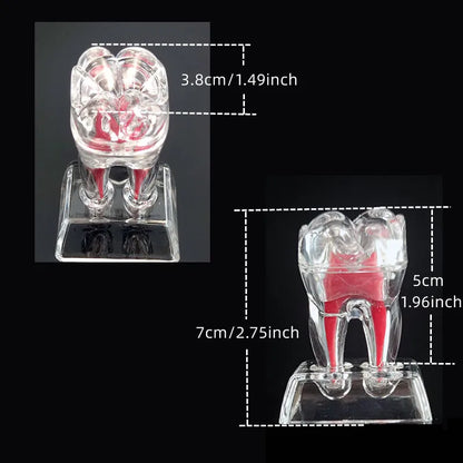 Dental Anatomical Model Transparent Luminous Detachable Single Tooth Decomposition Dentistry Clinic Ornaments 4xTeeth 70mm