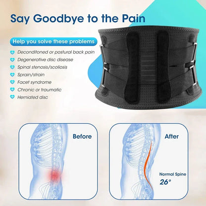 Back Brace For Lower Back Pain,With 4 Metal Supports,Four Elastic Bands,Breathable& Strong Support,Effectively Relieve Your Pain