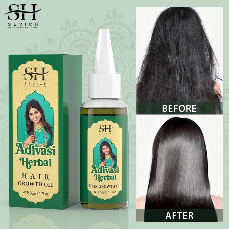 Ayurvedic Hair Growth Oil India Adivasi Organic Hair Growth Serum Anti Hair Loss Fast Regrowth Thicken Oils Hair Growth Products