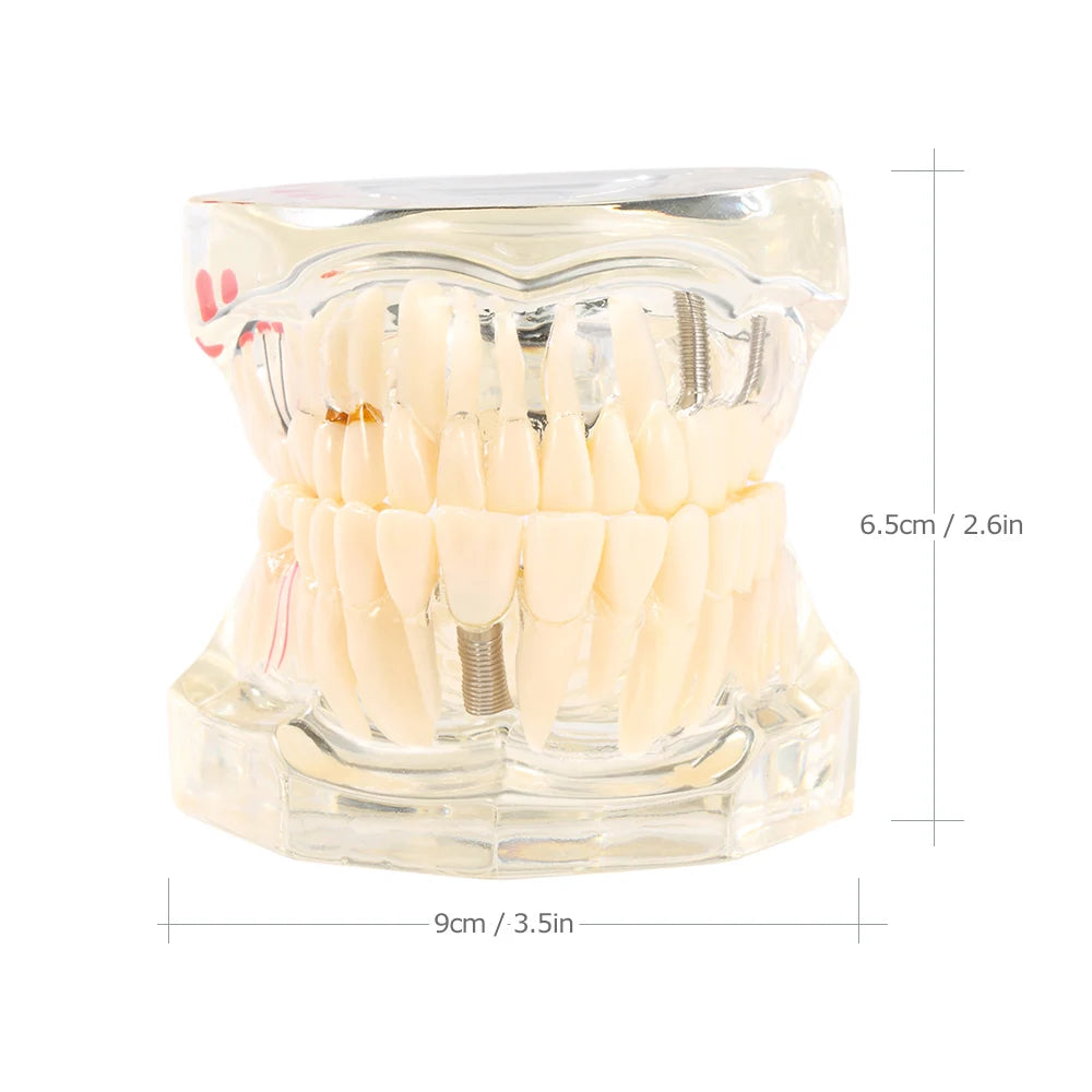 Dental Models Repairable Resin Models Of Diseased Teeth For Teaching And Research In Medicine And Dental Diseases