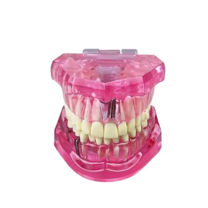 Dental Models Repairable Resin Models Of Diseased Teeth For Teaching And Research In Medicine And Dental Diseases