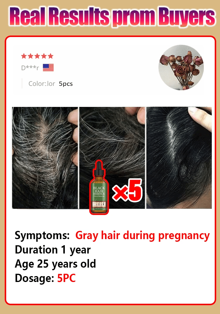 Anti Gray Hair Serum Remedy White Darkening Products