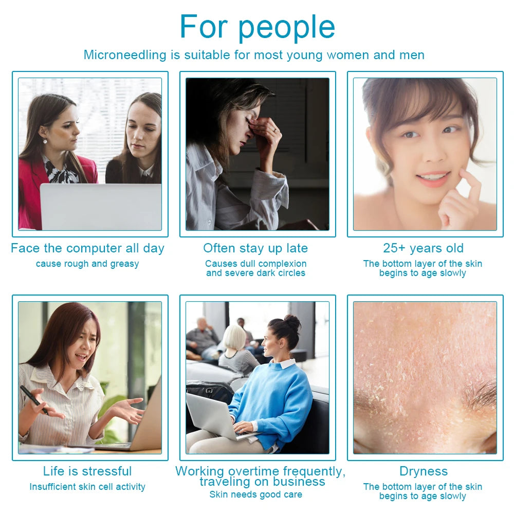 Professional 540 Needles for Facial Body Hair Growth Derma Roller for Skin Beard 0.2mm 0.25mm 0.3mm Needle Beauty Roller