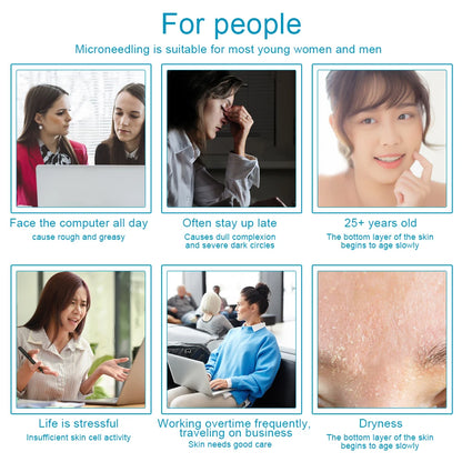 Professional 540 Needles for Facial Body Hair Growth Derma Roller for Skin Beard 0.2mm 0.25mm 0.3mm Needle Beauty Roller