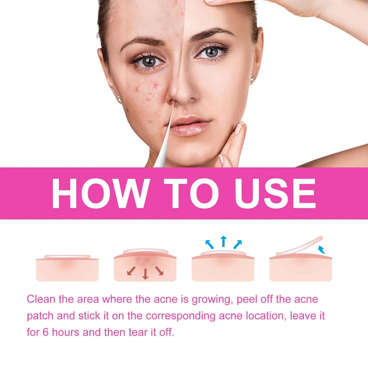 Pimple Patches for Face Cute Butterfly Shaped Acne Patches Hydrocolloid Cute Zit Stickers Parches Para Acne