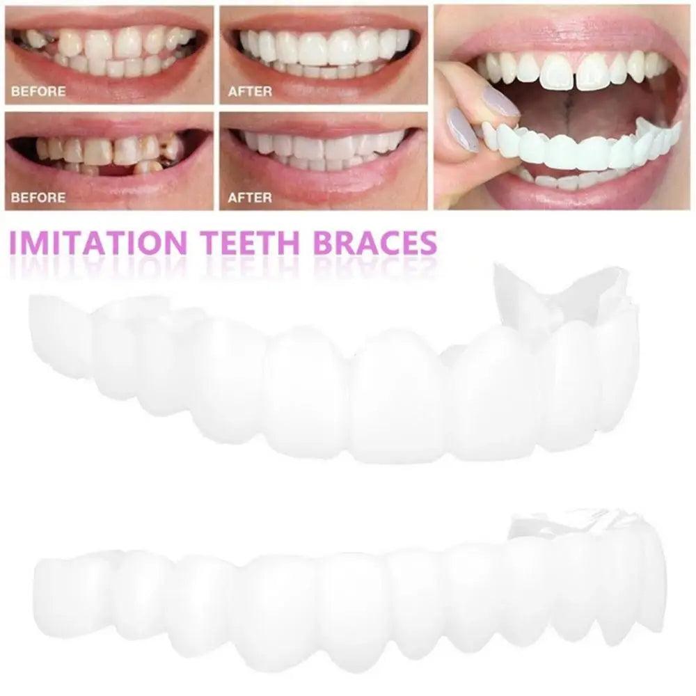 Snap On Teeth Veneers Cover The Imperfects Teeth Fake Tooth Instant Confidence Smile Temporary Teeth Teeth Beauty Tool Cosmetic