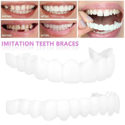 Snap On Teeth Veneers Cover The Imperfects Teeth Fake Tooth Instant Confidence Smile Temporary Teeth Teeth Beauty Tool Cosmetic