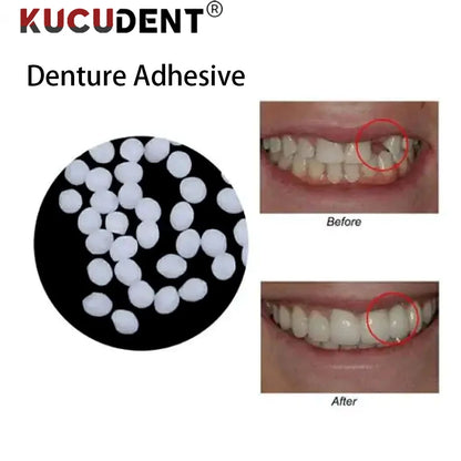 100g/50g Dental Resin Shapeable Teeth Glue Temporary Filling Teeth Repair Makeup Particles Teeth Whitening Tooth Beauty Tools