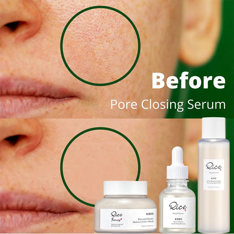 Beauty Rice Honey Facial Skincare 3pieces Set Moisturizing Arbutin Serum Milk Toner Smear Glow Mask Korean Brand Facial Skincare