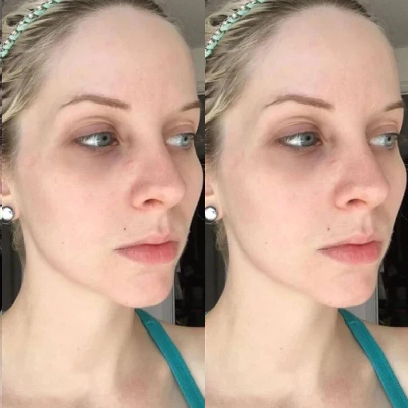 Face Collagen Peptide Hyaluronic Acid Face Mask DIY Hyaluronic acid V Face Lifting Firming Skin Rejuvenation Mask Skin Care