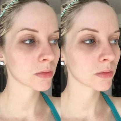 Face Collagen Peptide Hyaluronic Acid Face Mask DIY Hyaluronic acid V Face Lifting Firming Skin Rejuvenation Mask Skin Care