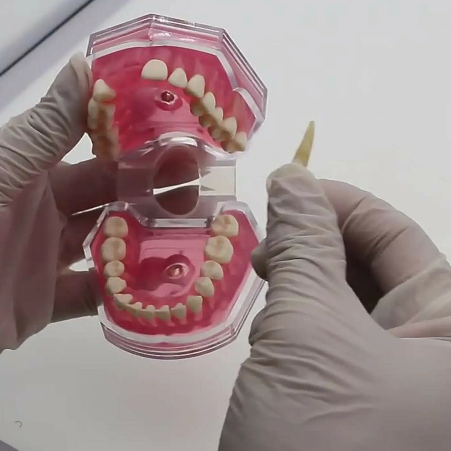 Dental Standard Typodont  Model Soft Gum  With 28 Removable Teeth Adult for Study Demo Teaching