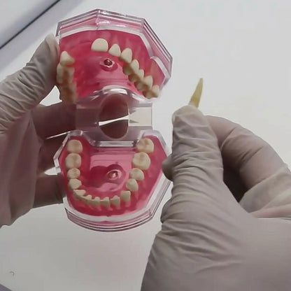 Dental Standard Typodont  Model Soft Gum  With 28 Removable Teeth Adult for Study Demo Teaching