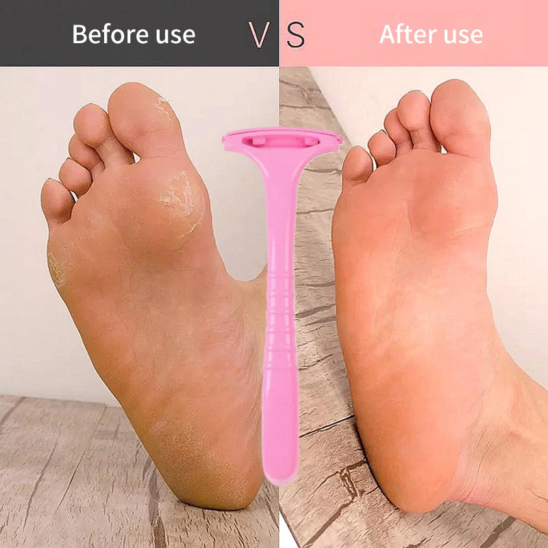 Professional Handle Dead Skin Calluses Removal Scraper Feet Care Nursing Plastic Portable Pedicure Massage Tool Beauty-health