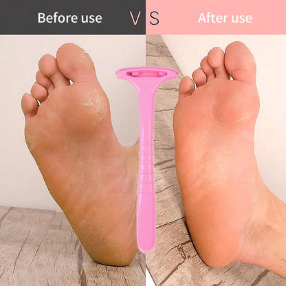 Professional Handle Dead Skin Calluses Removal Scraper Feet Care Nursing Plastic Portable Pedicure Massage Tool Beauty-health