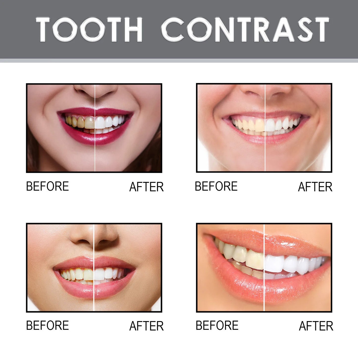 Tooth Paint, Instant Whitening Paint For Teeth, Teeth Stain Remover To Whiten Teeth, Tooth Polish Uptight 4ml