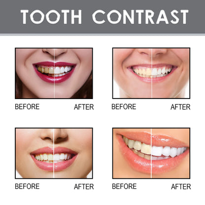 Tooth Paint, Instant Whitening Paint For Teeth, Teeth Stain Remover To Whiten Teeth, Tooth Polish Uptight 4ml