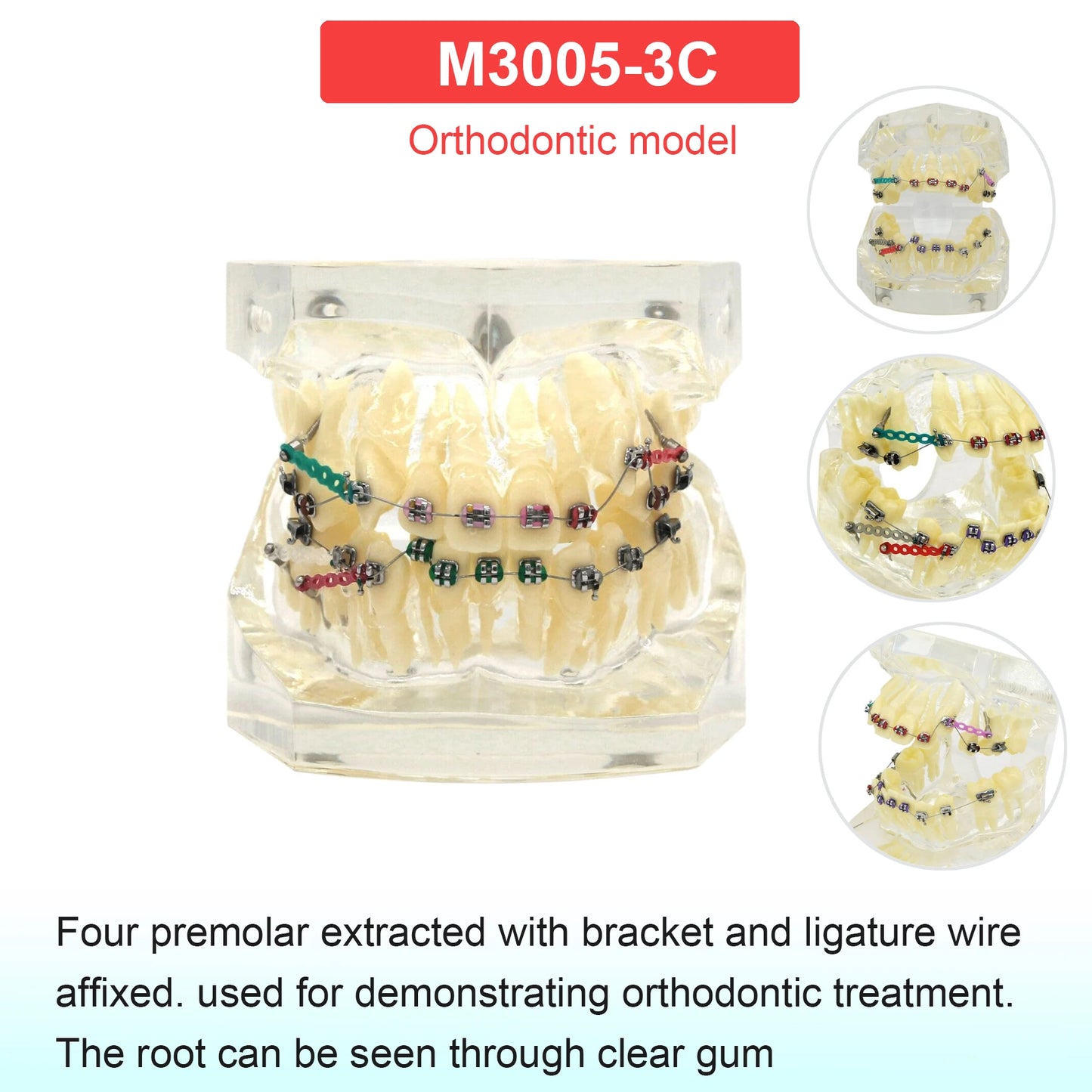 Dental Teeth Model Dental Teaching Models Implant Model Removable Dentistry Model Teeth For Training Studying Patient Education