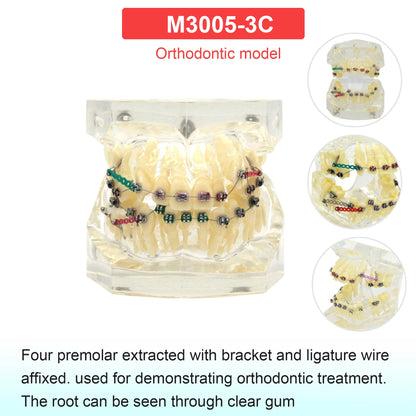 Dental Teeth Model Dental Teaching Models Implant Model Removable Dentistry Model Teeth For Training Studying Patient Education