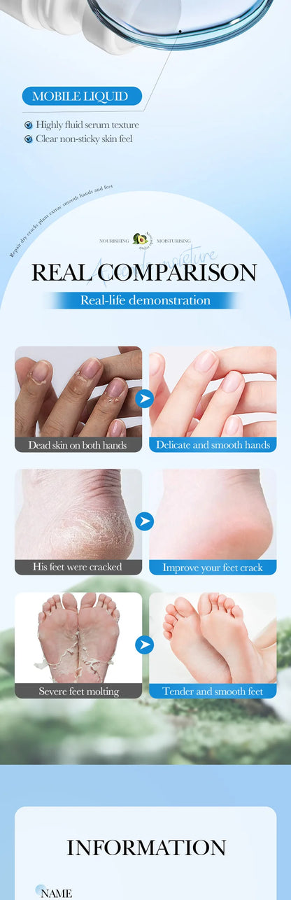 Avocado Hand and Foot Cream Condensation Bead Rolling Creams Moisturizing Nourishing Repairing Feet Hands skincare Creams