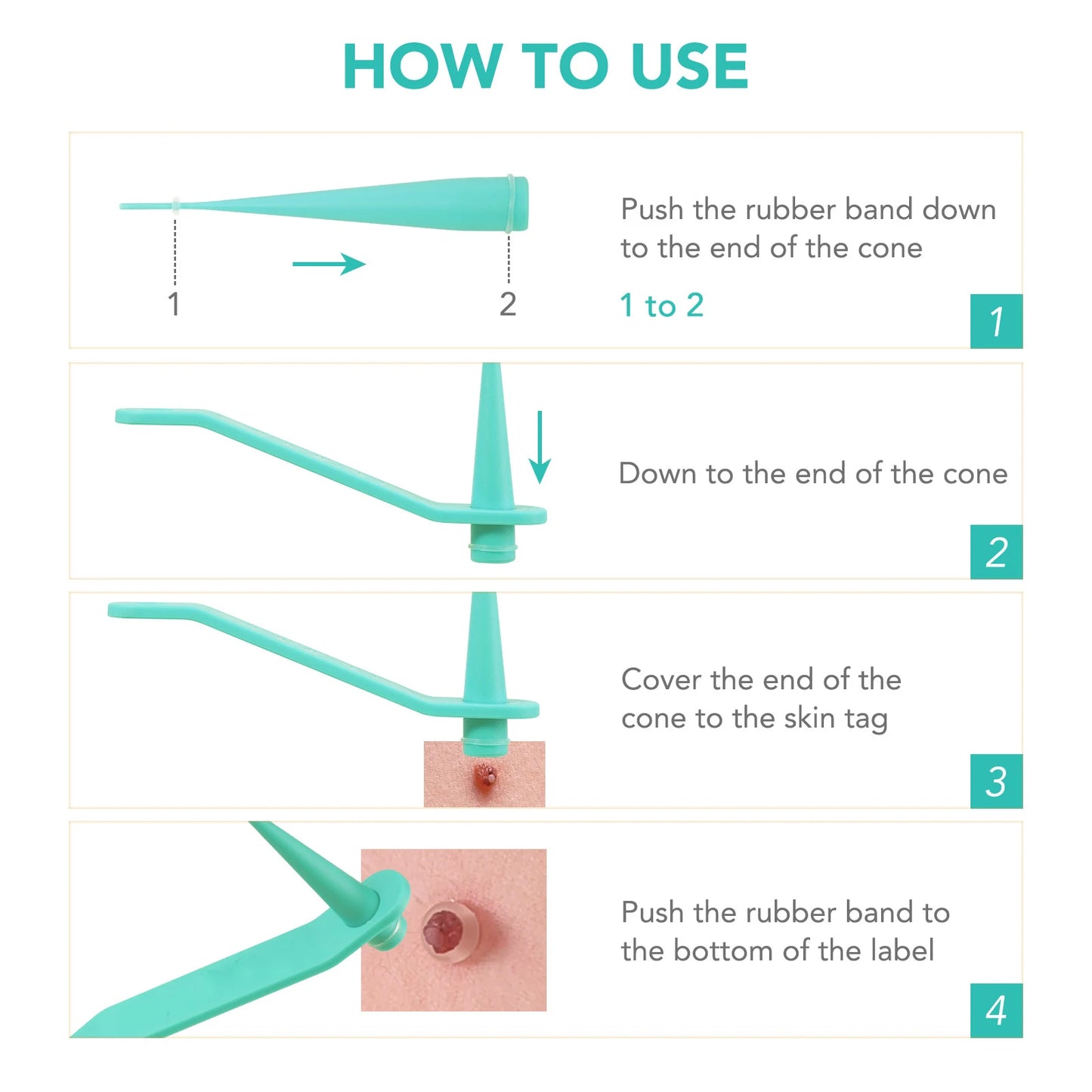 Simple Wart Removal Tool Set Skin Tag Removeal Tool Easy To Clean Skin Care Tool Skin Tag Removal Care Products