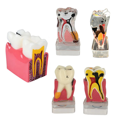 41 Styles Dental Model Teeth Teaching Model Dentist Typodont Orthodontic Jaw Model For Studying   Dentistry Products Accessories