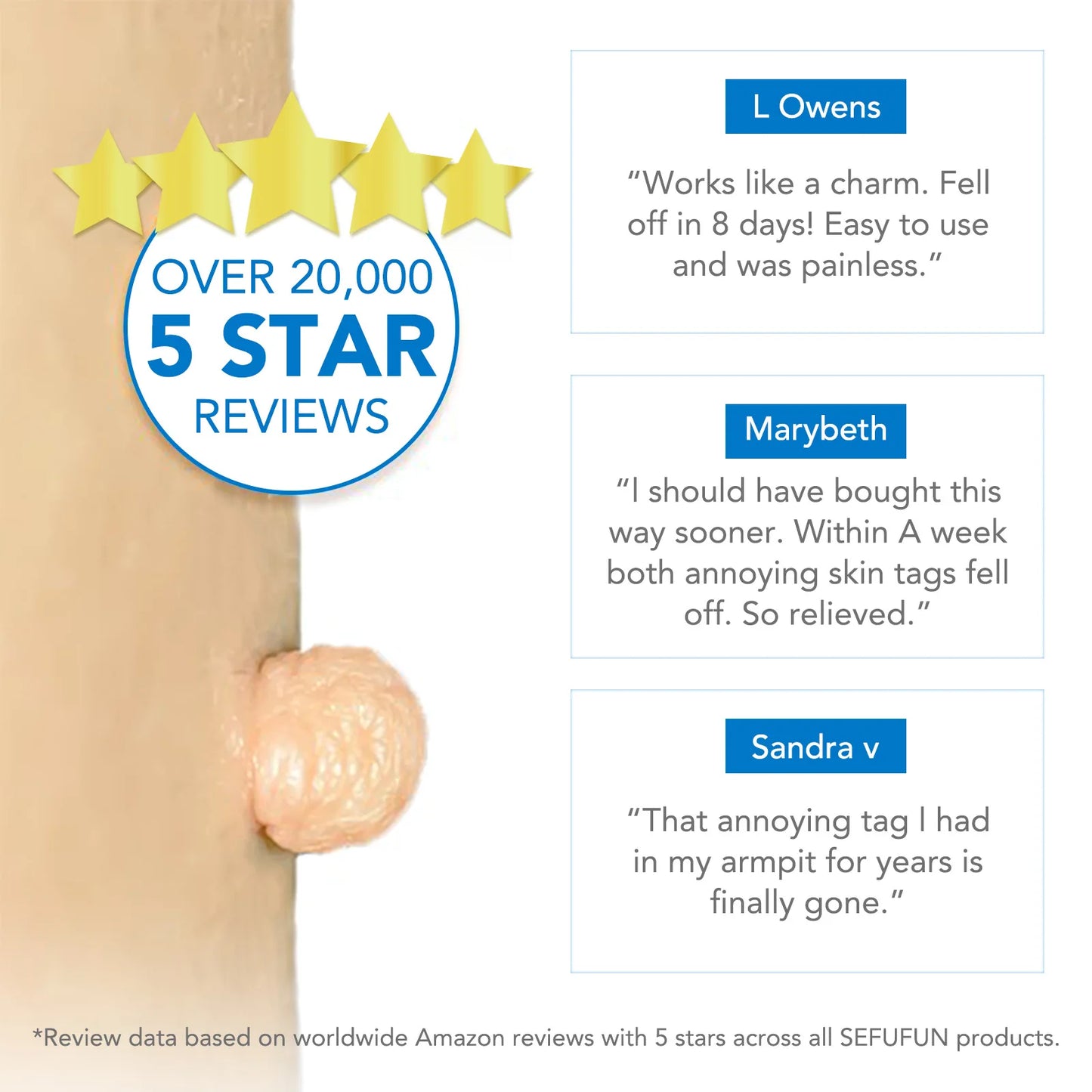 Simple Wart Removal Tool Set Skin Tag Removeal Tool Easy To Clean Skin Care Tool Skin Tag Removal Care Products